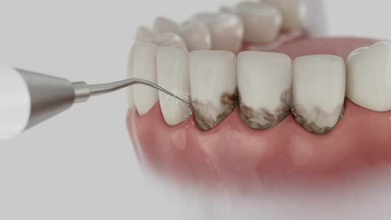 Trusted Dental Implants service in Forest, MS - Dentist Open Now